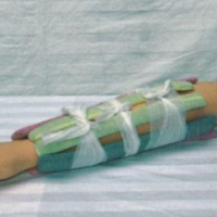 KAY/ZGZ-1上臂骨折模型-上肢骨折模型上海康谊公司厂家