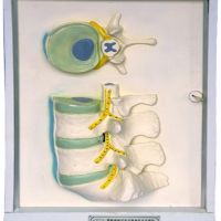 康谊牌ZM0031腰骶椎、椎间盘与脊神经电动模型